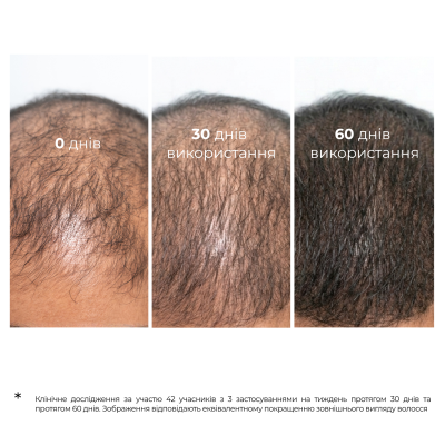 5901845500203_UA_pr_period_PL_4