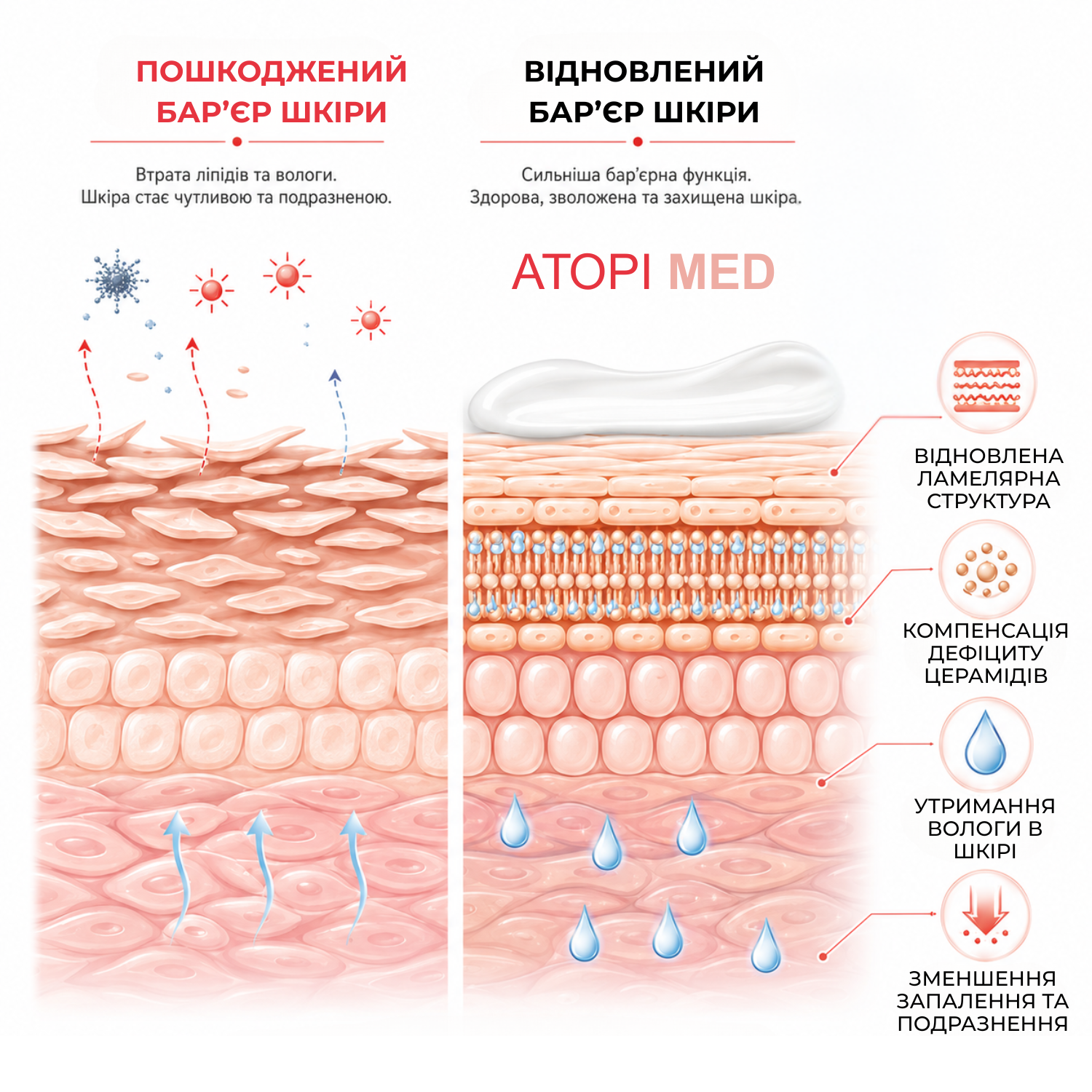 Пом'якшувальне молочко Elfa Pharm Atopi Med 400 мл