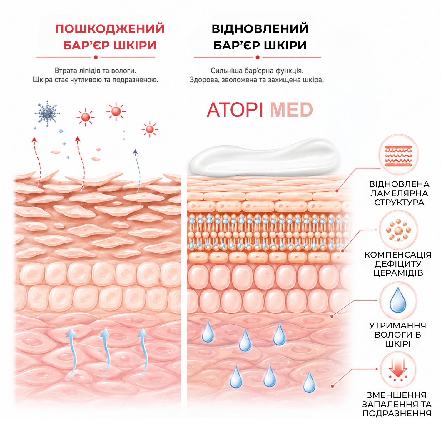Пом'якшувальне молочко Elfa Pharm Atopi Med 400 мл
