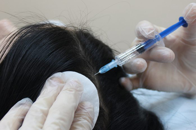 выпадение9.jpg выпадение9.jpg